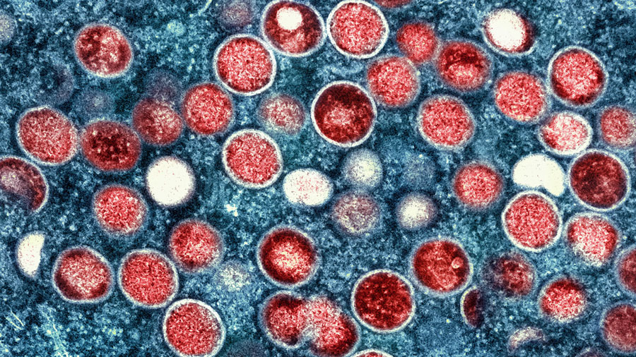 Colorized transmission electron micrograph of monkeypox particles (red) found within an infected cell (blue), cultured in the laboratory. Image captured and color-enhanced at the NIAID Integrated Research Facility (IRF) in Fort Detrick, Maryland. Credit: NIAID via Creative Commons