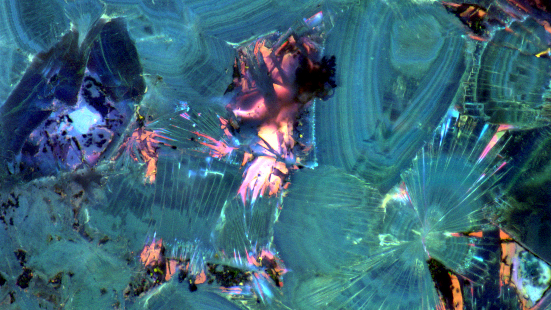 microscopic view of a kidney stone shows beauty of its geological make-up