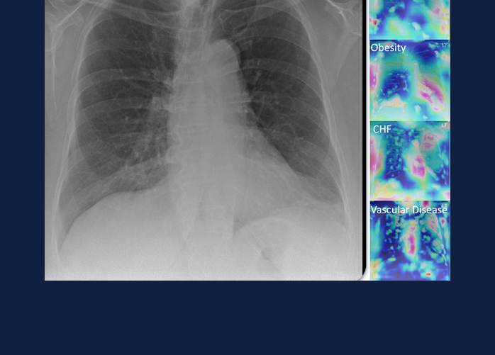 lung x-ray photos provided by the Coordinated Sciences Lab