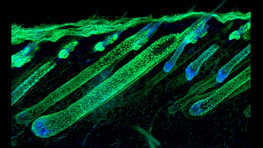 Image of a hair follicle, incuded in the article, “Hedgehog signaling reprograms hair follicle niche fibroblasts to a hyper-activated state,“ published in Developmental Cell.