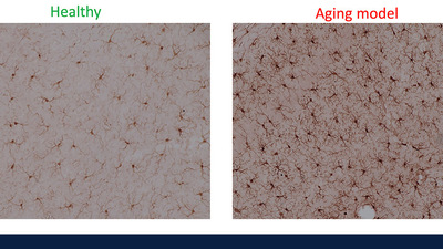 Immunohistochemical staining of Iba-1, a marker of microglial activation. Photos by Uwe Rudolph