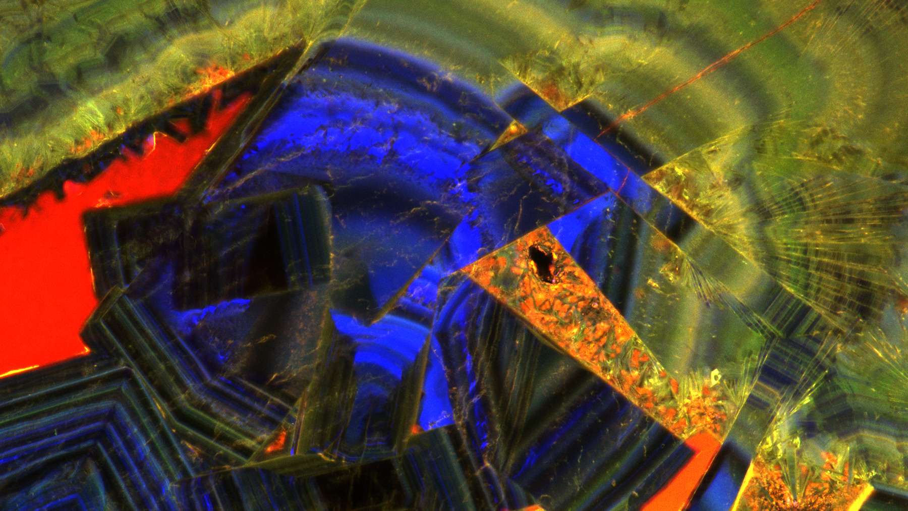 A fluorescent microscope image of a thin section of a human kidney stone reveals a complex history of crystal growth layering, fracturing, dissolution and recrystallization.  Image courtesy of Mayandi Sivaguru