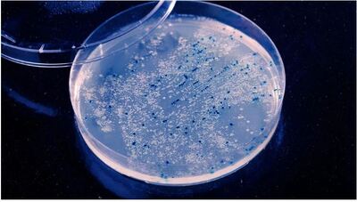 blue tinted image of bacteria in a petri dish. WLADIMIR BULGAR/Getty Images