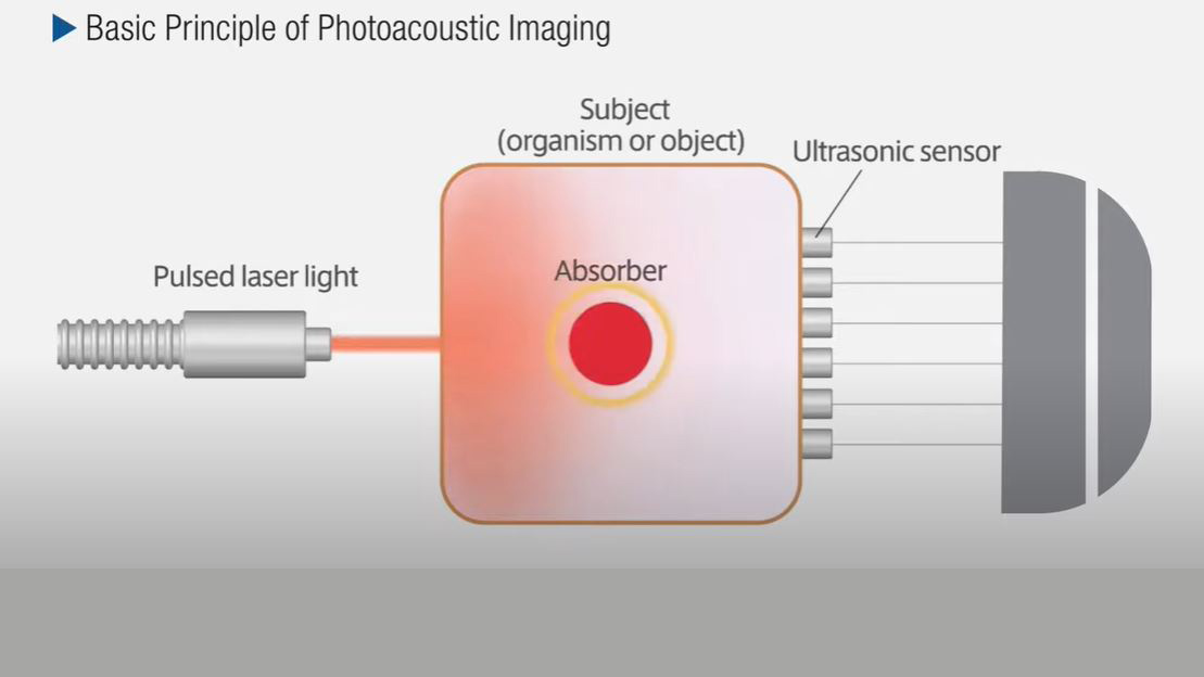 graphic shows the basic premise of using a light-based input to get a sound-based output image of biopsy