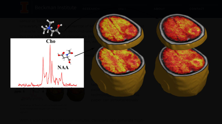 Illustration of Guo's method to generate 3D high-resolution brain metabolite maps from the tissue intrinsic spectroscopic signals.