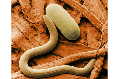 The soybean cyst nematode is a major pathogen of soybeans. A juvenile nematode is pictured here with an egg.