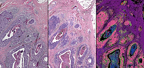 [Image ID: three side-by-side images of the same pink-tinged cell tissue, which are amorphous blobs with other blobs of different shades inside. The image on the left has the least distinct detail, and what look like white scratches distorting some of the color of the image. The one in the center is a lighter pink with more distinct purple details. The one on the left is deeply saturated purple, with pink, blue, black, and green details that show up very distinctly. End ID]