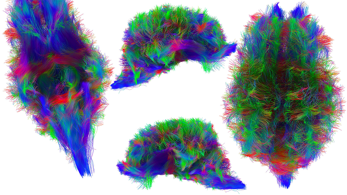 MRI of a pig brain displayed in bright blue, green, pink and red tightly connected lines that look like brush strokes.