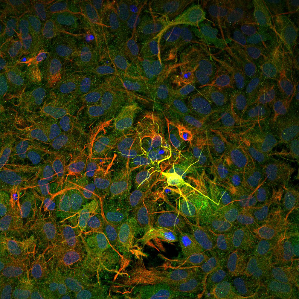 A single yellow neuron against a multi-colored background connected to smaller pathways.