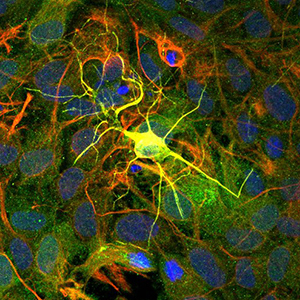 A single yellow neuron against a multi-colored background connected to smaller pathways.